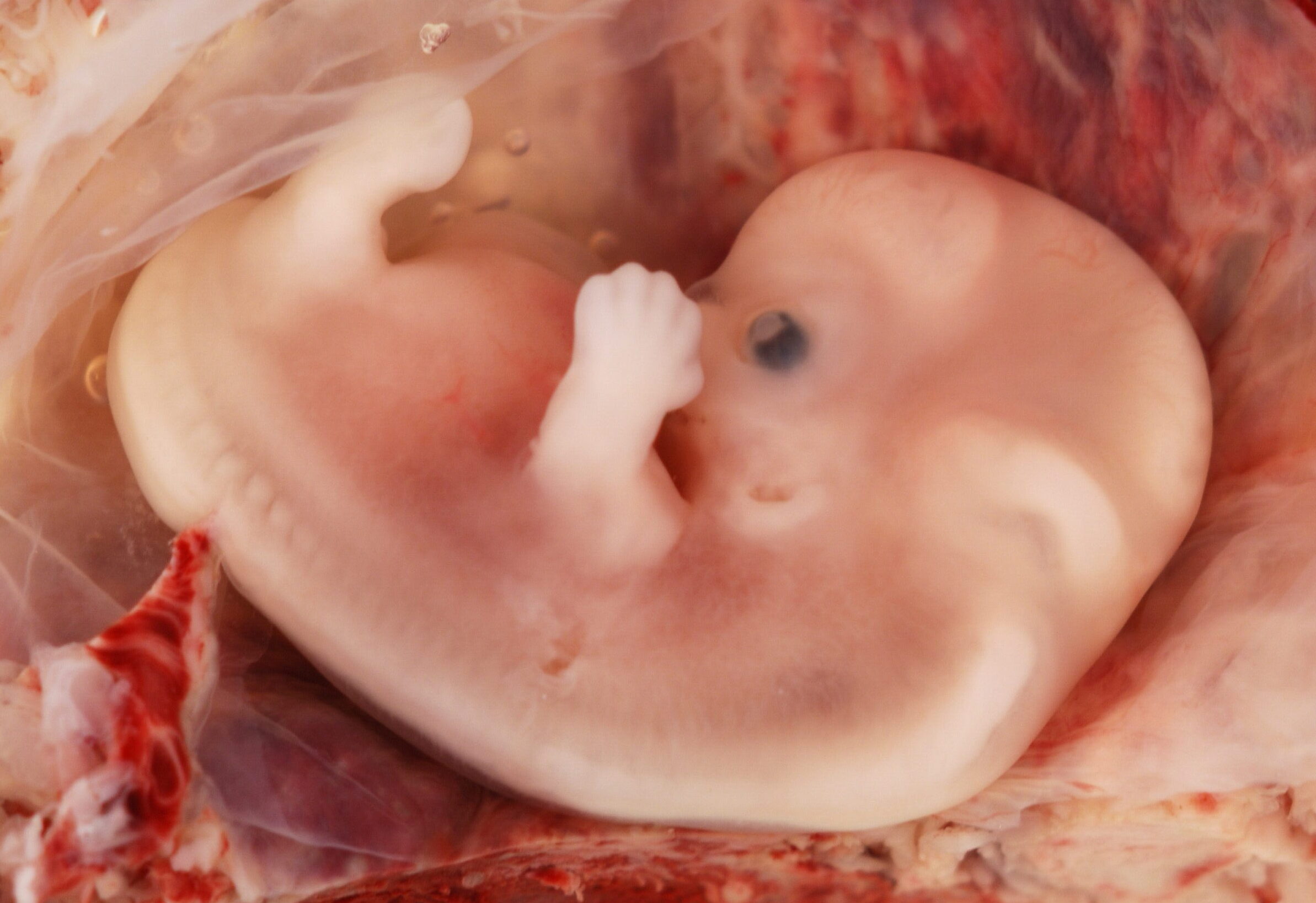 Criminalize Abortion As Murder